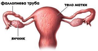 Лечение трубно перитонеального бесплодия